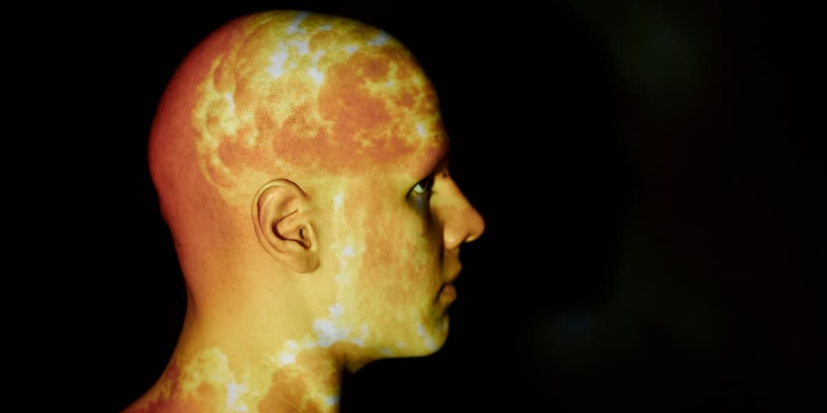 Intermittent Explosive Disorder